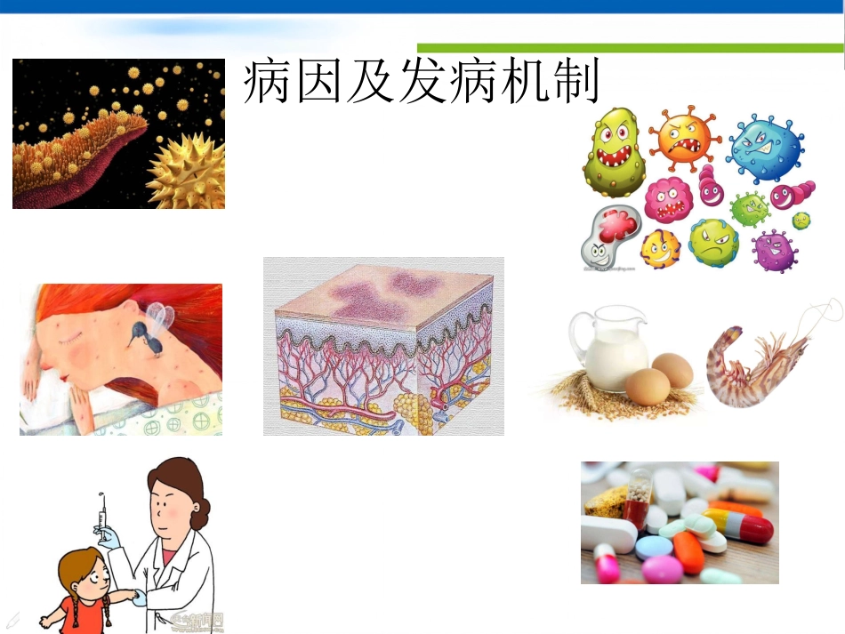 过敏性紫癜_第4页