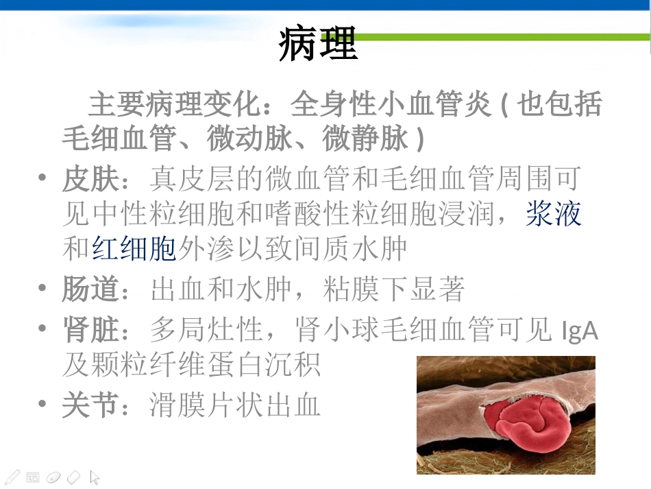 过敏性紫癜_第6页