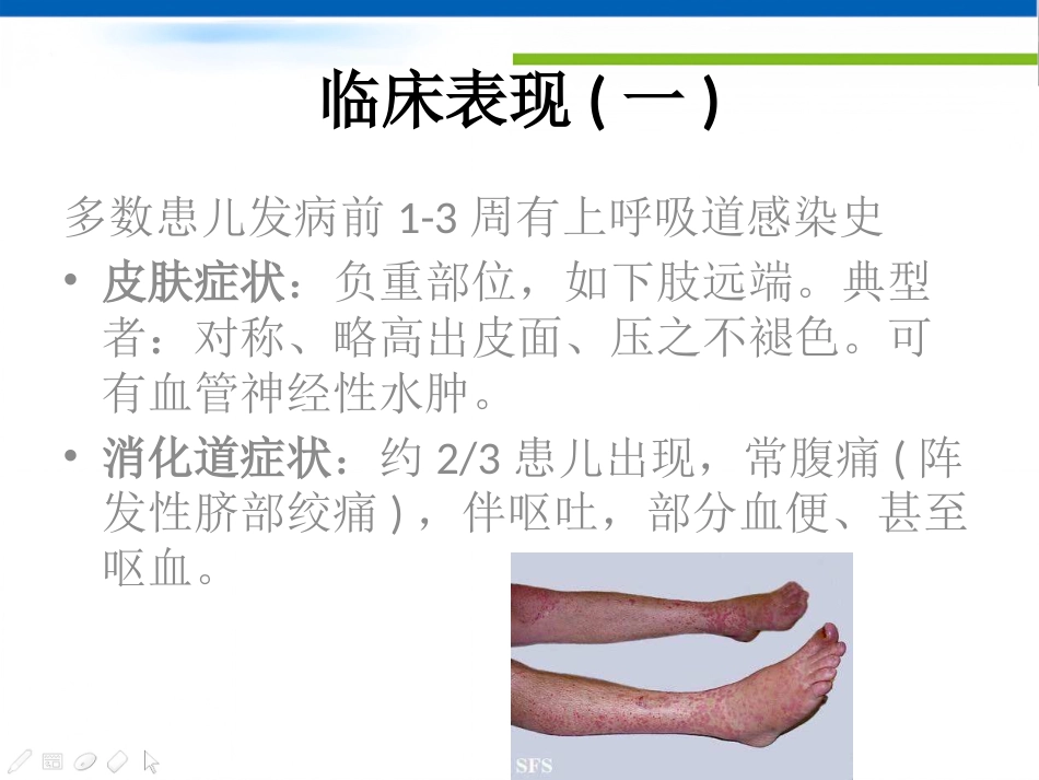 过敏性紫癜_第7页