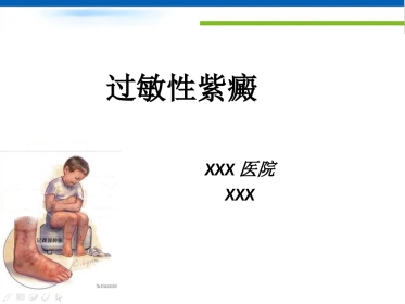 过敏性紫癜