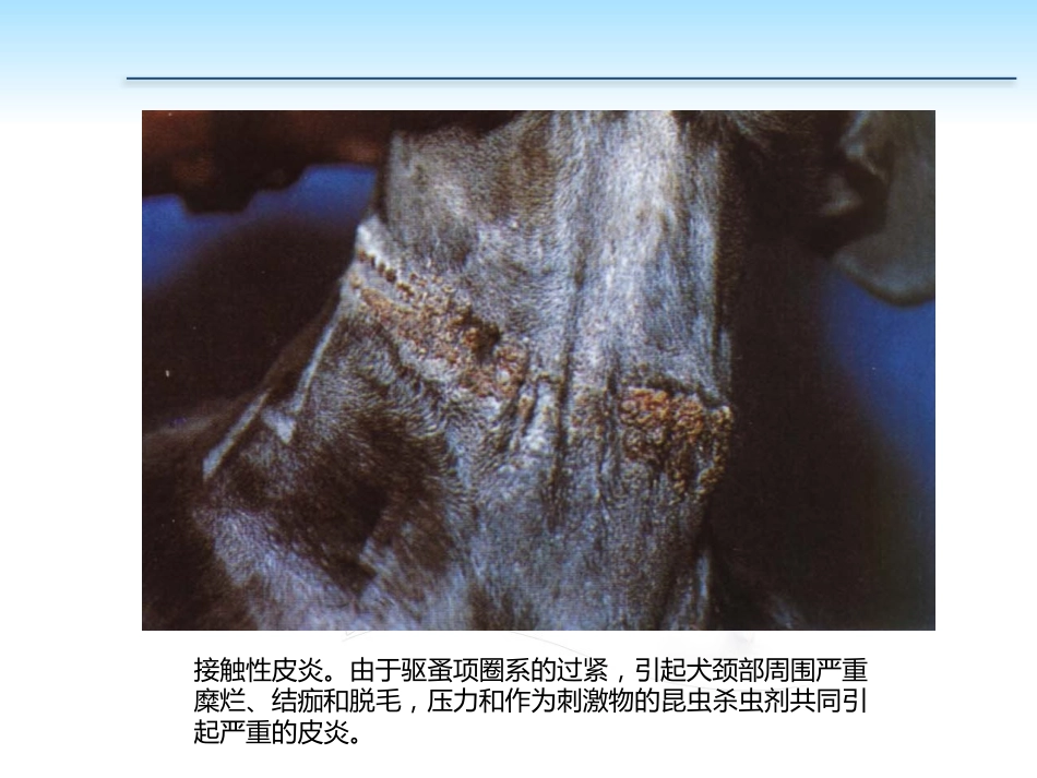 PP105-00b任务5过敏性皮肤病的诊治_第10页