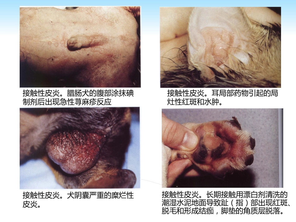 PP105-00b任务5过敏性皮肤病的诊治_第11页