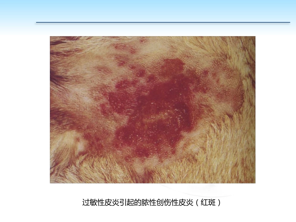PP105-00b任务5过敏性皮肤病的诊治_第8页