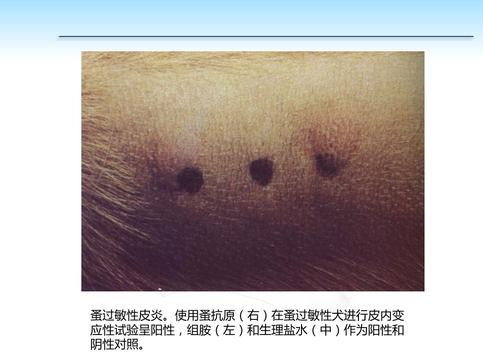PP105-00b任务5过敏性皮肤病的诊治_第9页