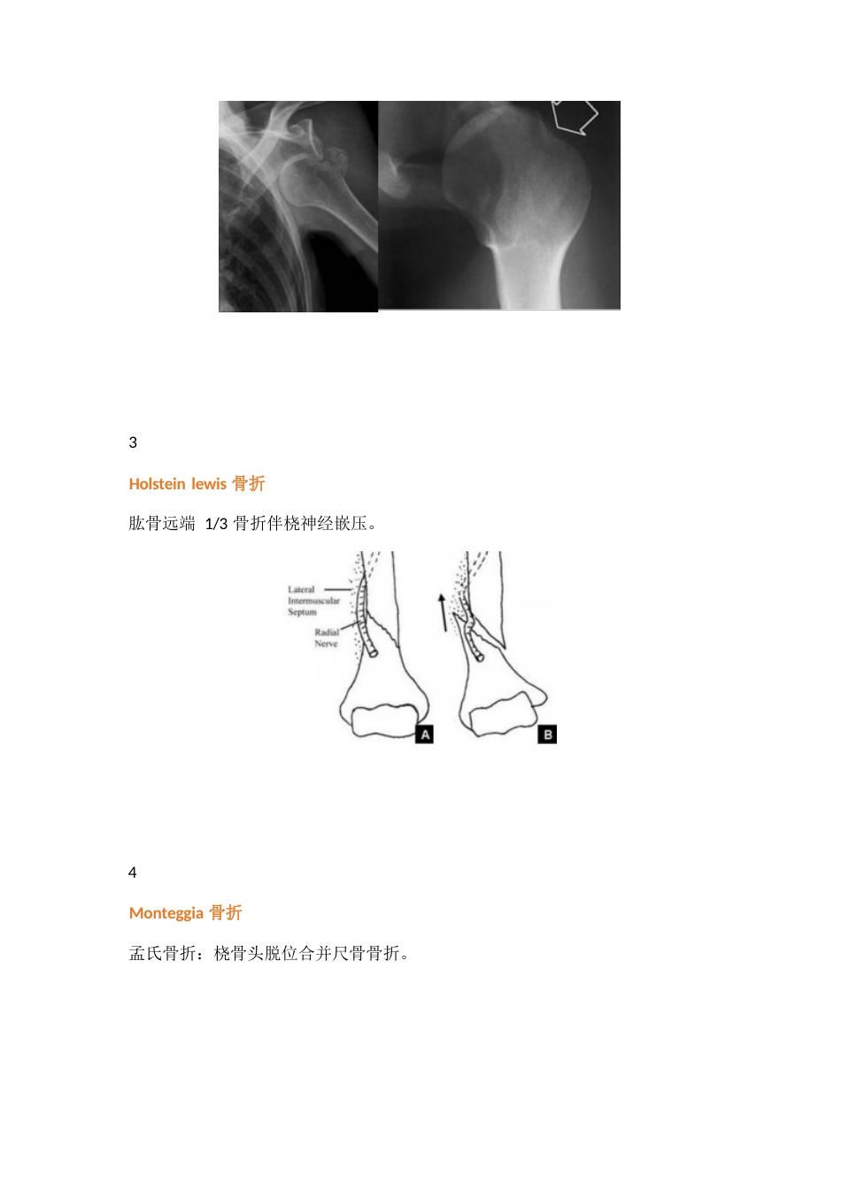 38种特殊类型的骨折_第2页