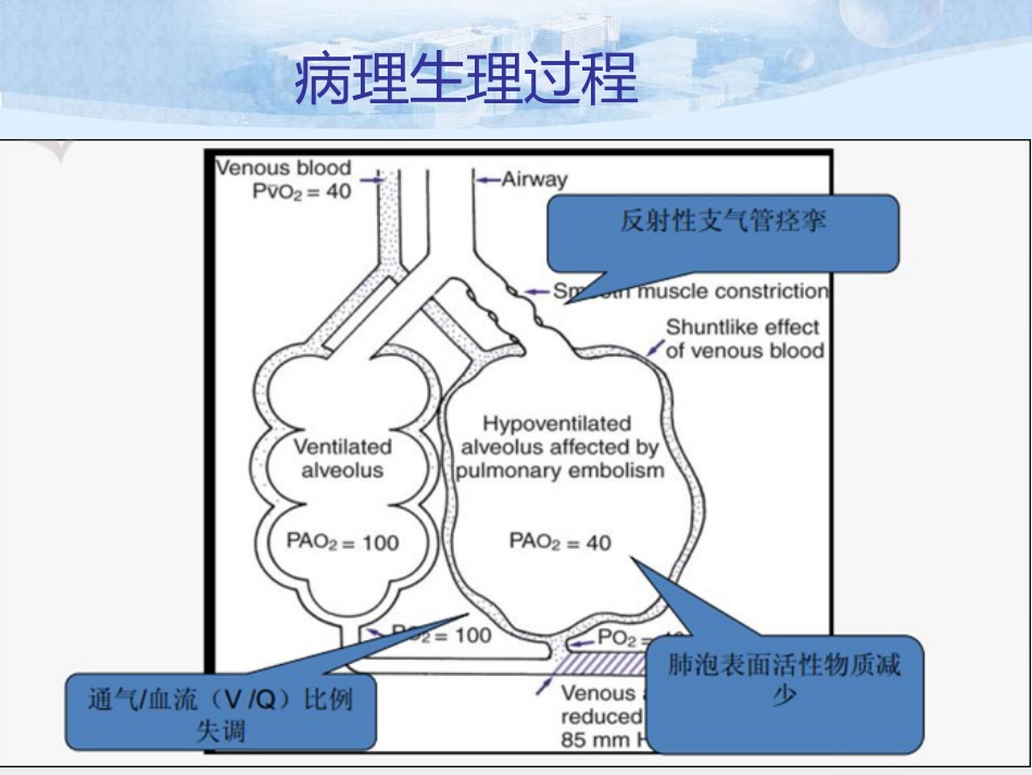 肺栓塞的诊治及护理_第11页