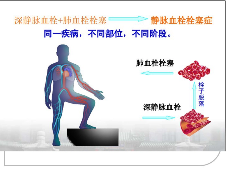 肺栓塞的诊治及护理_第7页