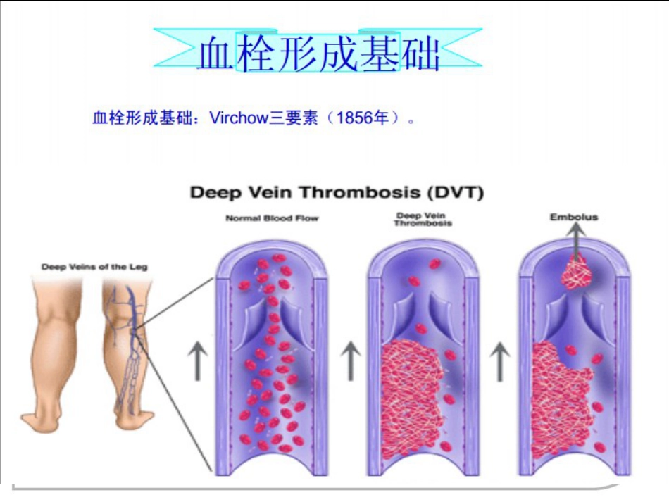 肺栓塞的诊治及护理_第9页