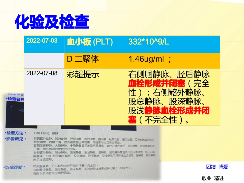 一例右下肢血栓合并肺栓塞患者的护理个案_第9页