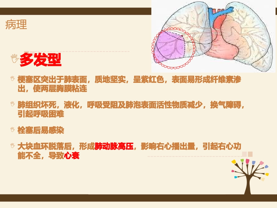 肺栓塞病人的护理5_第12页
