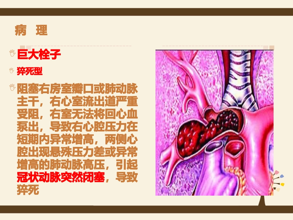 肺栓塞病人的护理5_第13页