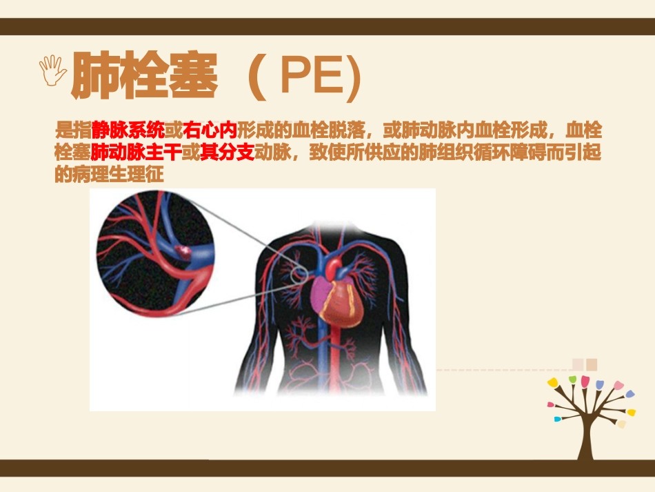 肺栓塞病人的护理5_第3页