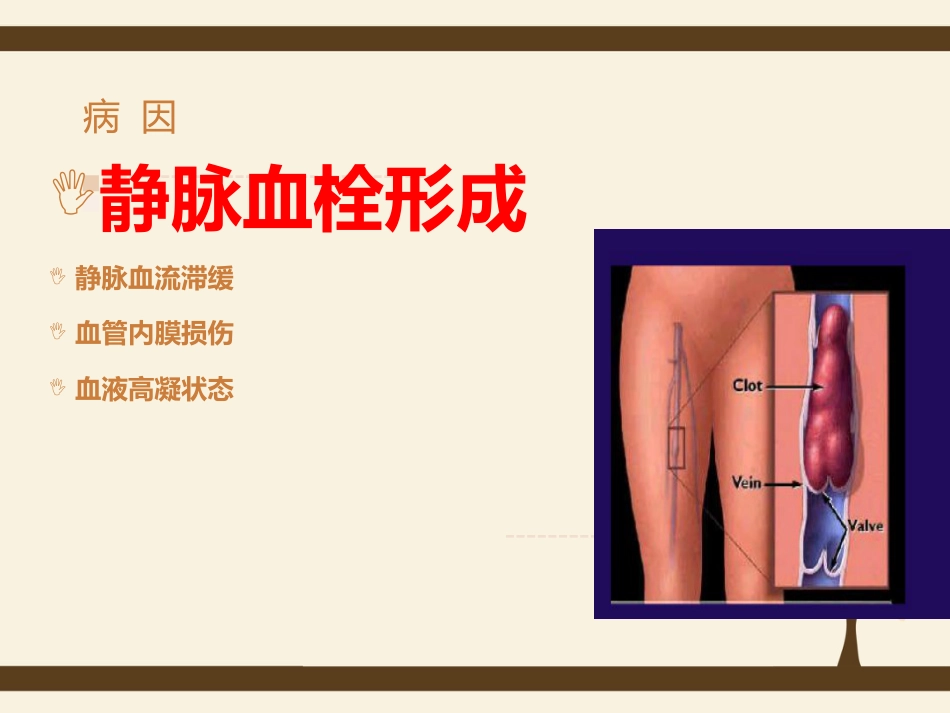 肺栓塞病人的护理5_第6页