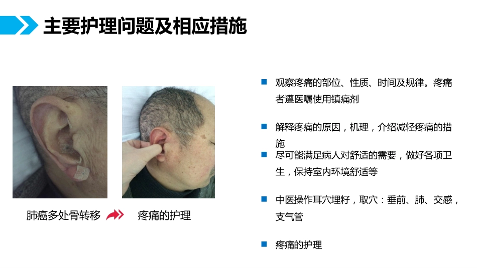 一例肺癌腹膜转移患者的护理体会_第10页