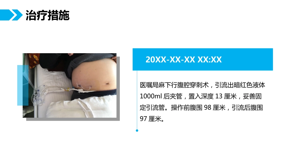 一例肺癌腹膜转移患者的护理体会_第6页