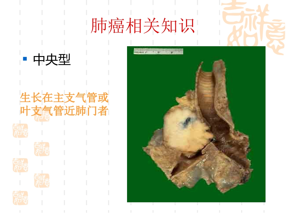 肺癌护理疑难病例讨论_第8页