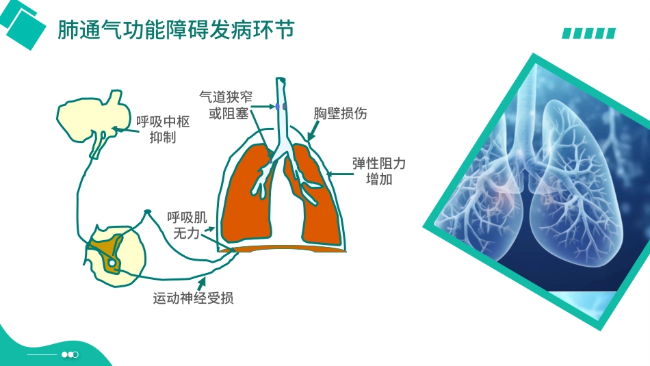 呼吸衰竭培训_第9页