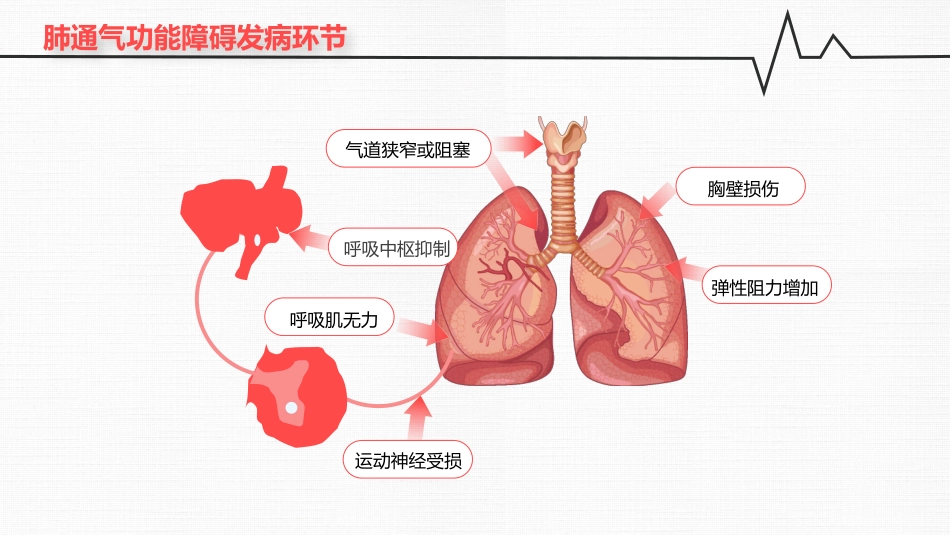 呼吸衰竭_第9页