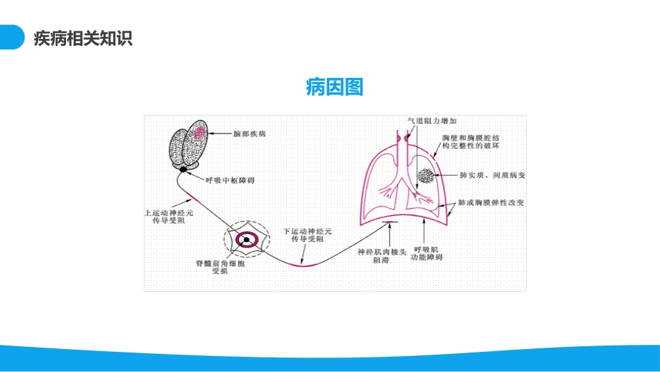 呼吸衰竭病例分析_第11页