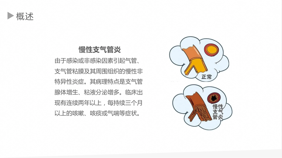 慢性支气管炎1_第4页