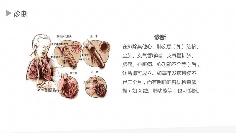 慢性支气管炎1_第5页