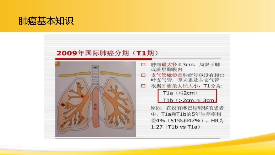 肺癌1_第14页