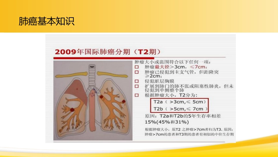 肺癌1_第15页