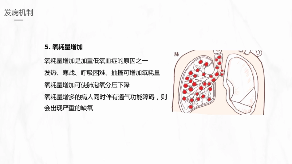 呼吸衰竭的护理1_第13页