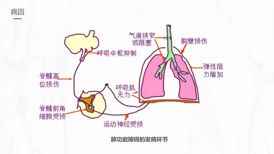 呼吸衰竭的护理1_第6页