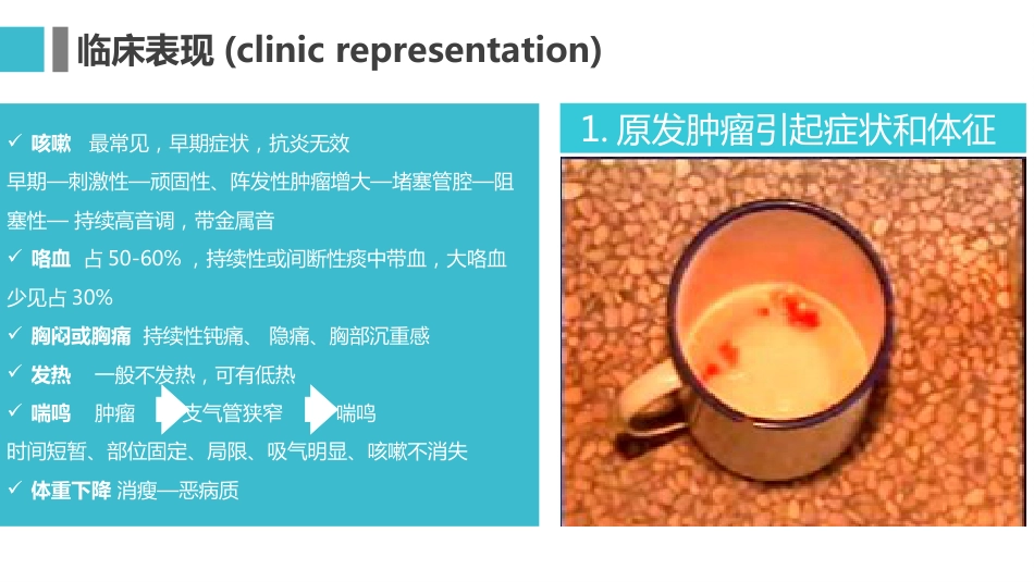 原发性支气管肺癌1_第14页