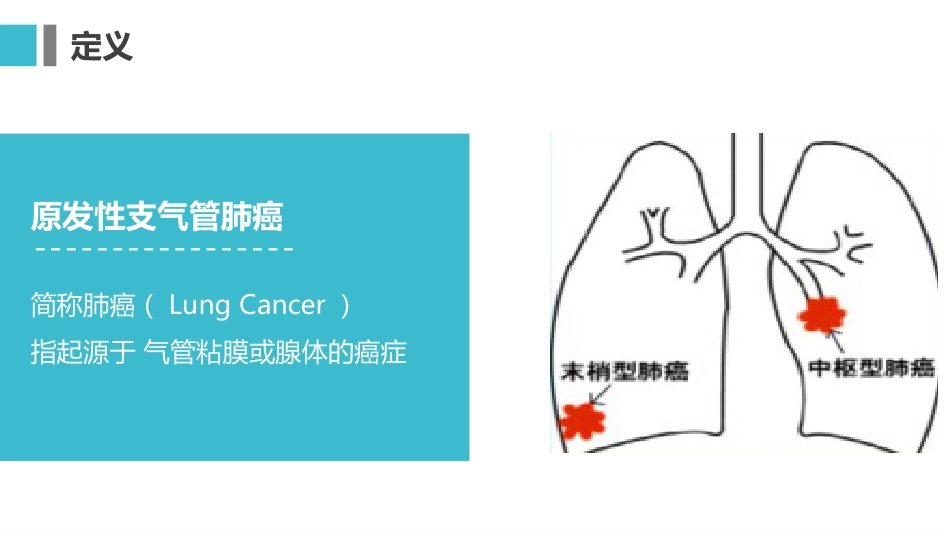 原发性支气管肺癌1_第3页
