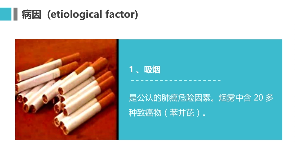 原发性支气管肺癌1_第7页