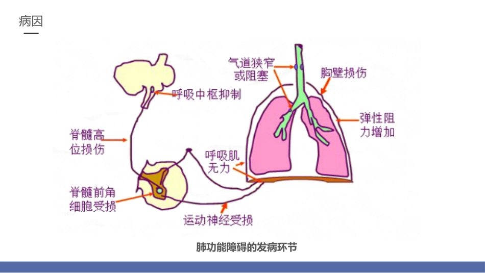 呼吸衰竭的护理2_第6页