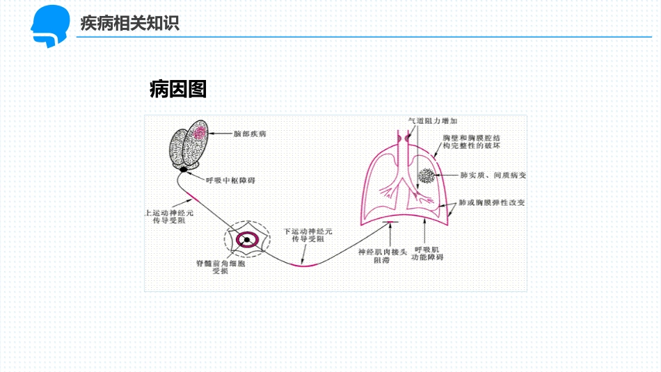 呼吸衰竭病人护理查房2_第12页