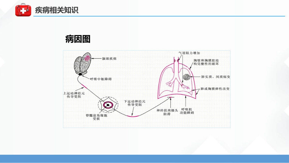 呼吸衰竭病人护理查房5_第12页
