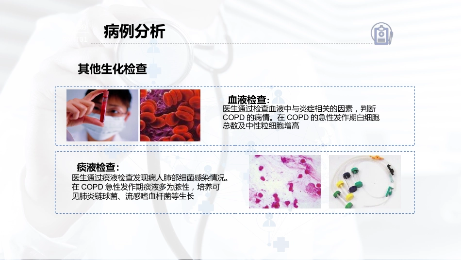 COPD患者护理查房7_第13页