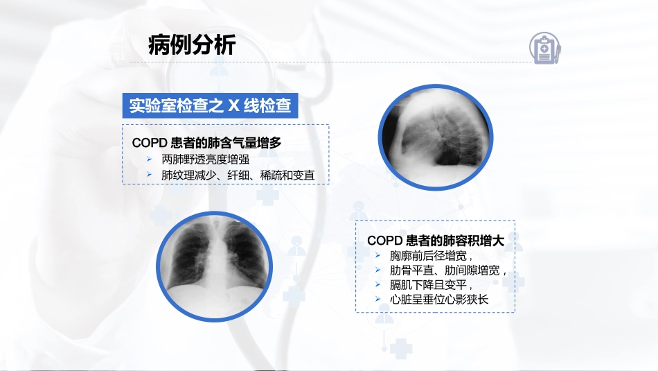 COPD患者护理查房7_第14页