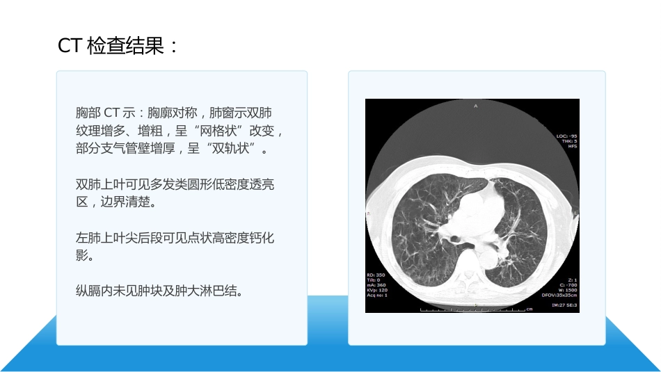 呼吸衰竭病人护理查房9_第6页