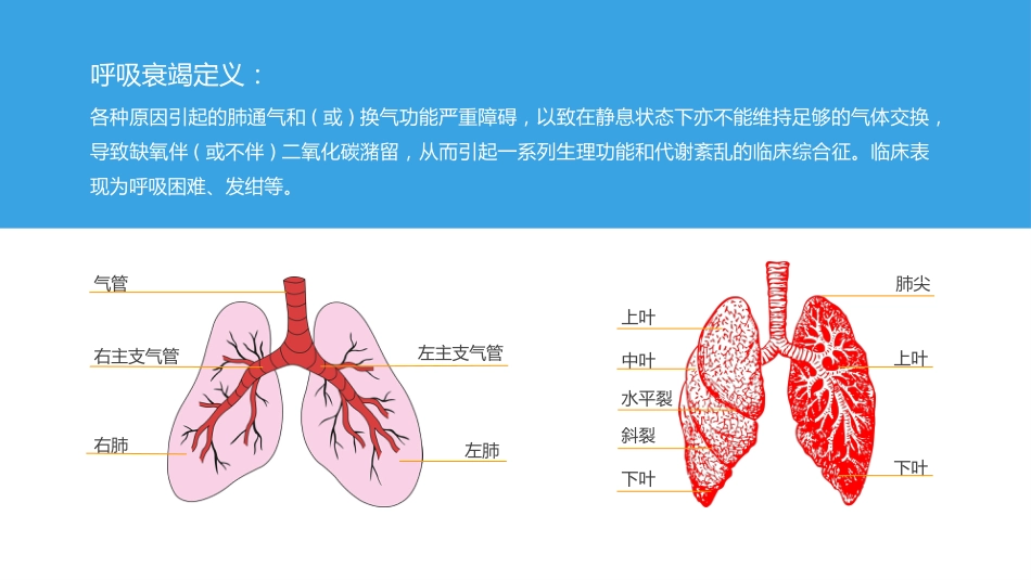 呼吸衰竭病人护理查房9_第7页