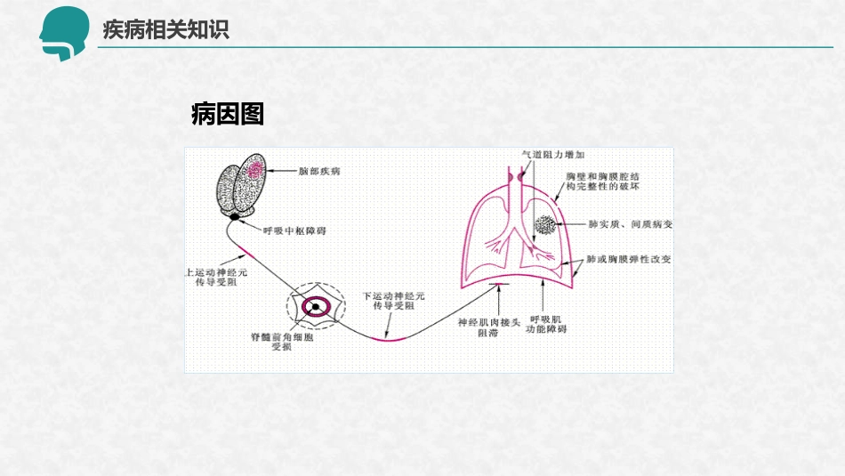 呼吸衰竭的护理查房12_第12页