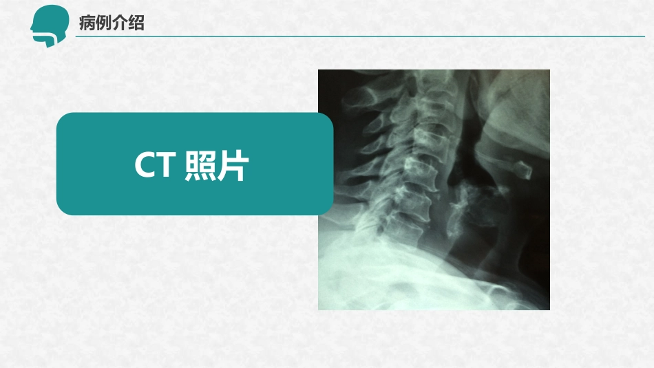 呼吸衰竭的护理查房12_第6页