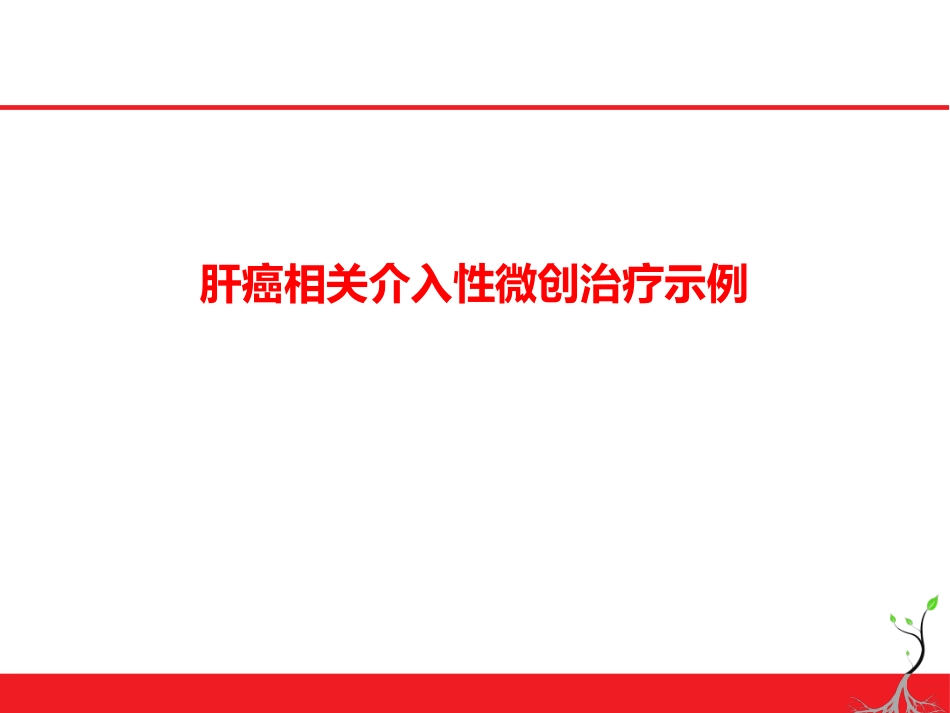 肝癌微创治疗简论_第14页