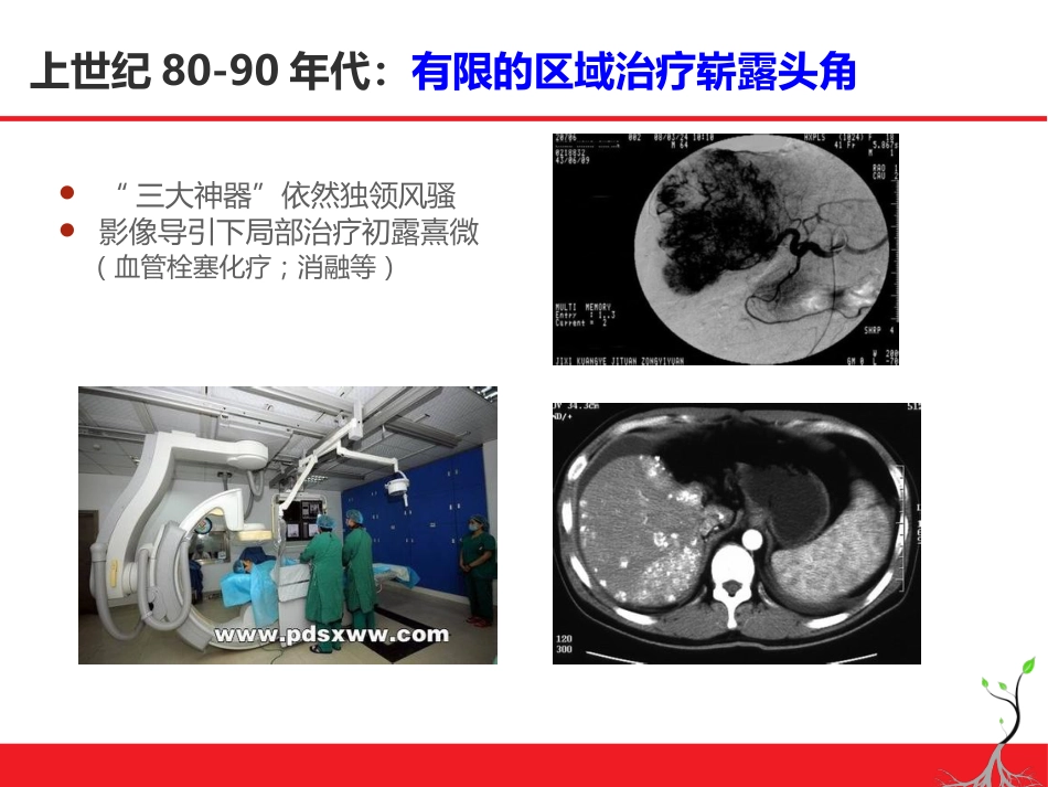 肝癌微创治疗简论_第4页