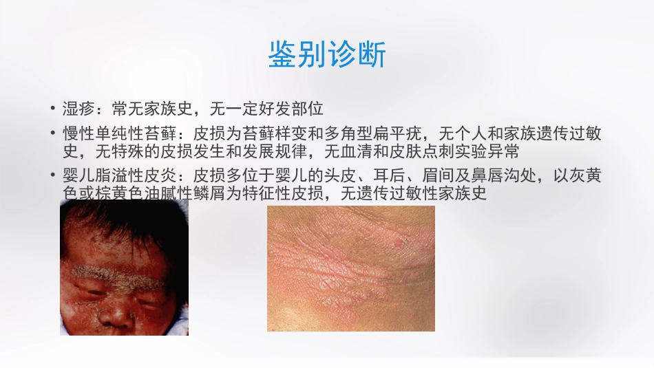 变态反应性皮肤病_第12页