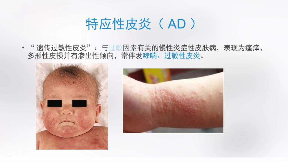 变态反应性皮肤病_第2页