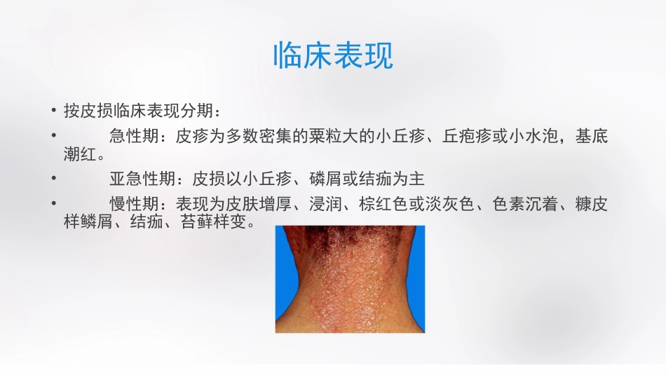 变态反应性皮肤病_第5页
