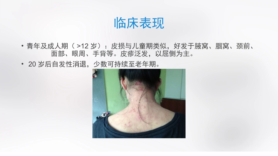 变态反应性皮肤病_第8页