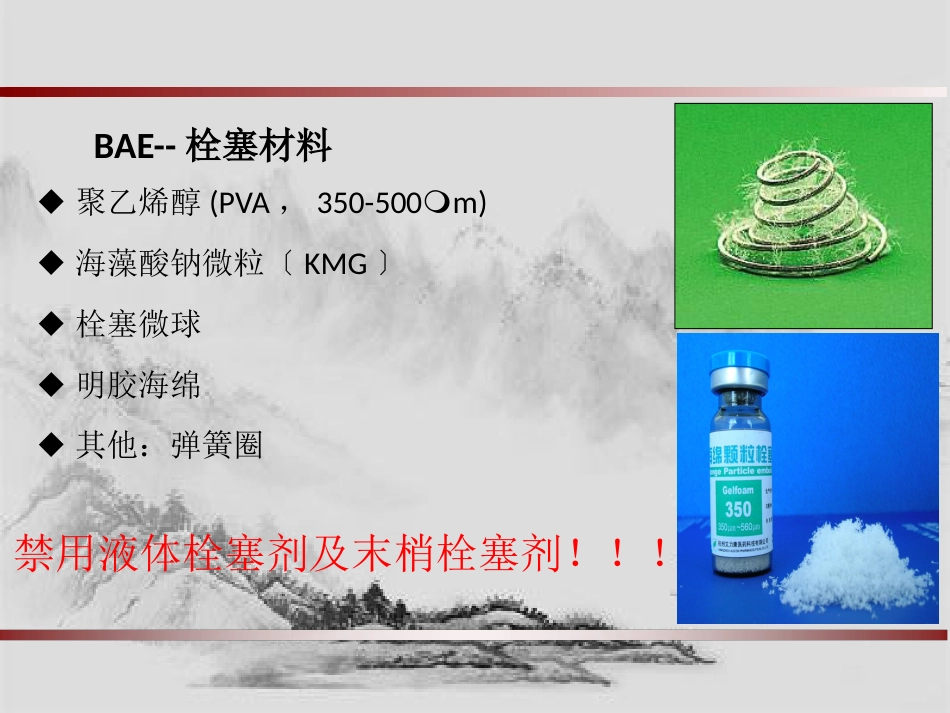 大咯血的介入治疗_第15页