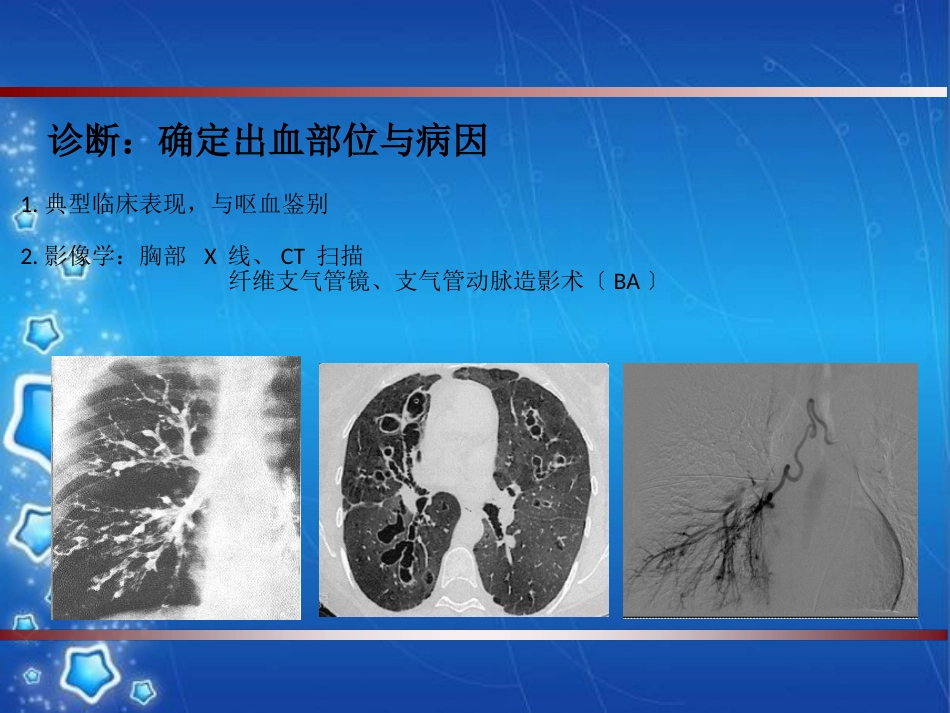 大咯血的介入治疗_第4页