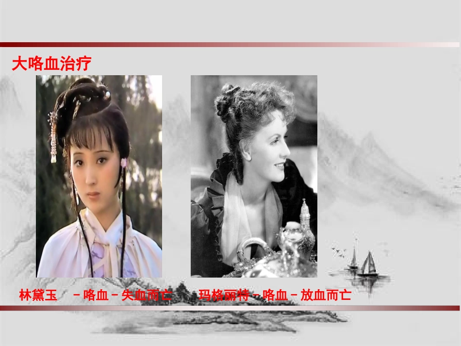 大咯血的介入治疗_第8页